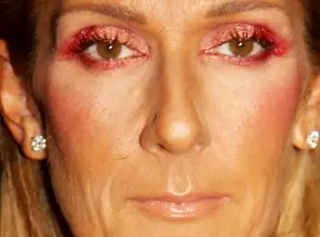 Céline Dion paralysée : les dernières nouvelles concernant la santé de la star sont très inquiétantes !