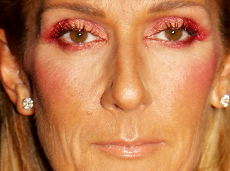 Céline Dion paralysée : les dernières nouvelles concernant la santé de la star sont très inquiétantes !